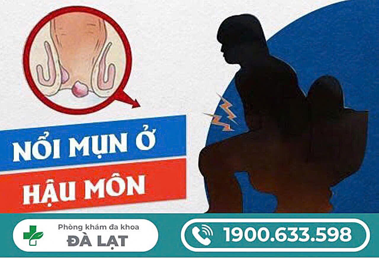 Hình ảnh minh họa